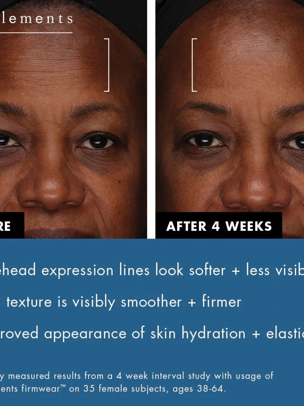 Bioelements | Firmwear Biotech Firm + Lift Serum